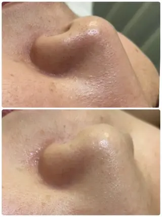 aroma  YURARI所属・韓国艶美人// 毛穴ケア🌹のエステ・リラクイメージ