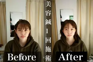 鍼灸整骨院Refine所属・鍼灸 Refineのその他イメージ