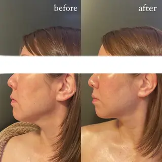 エステサロンino.colore'所属・小顔サロン ino.coloreのエステ・リラクイメージ