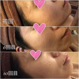 毛穴ニキビ専門 ビューティーグランツのエステ・リラクイメージ