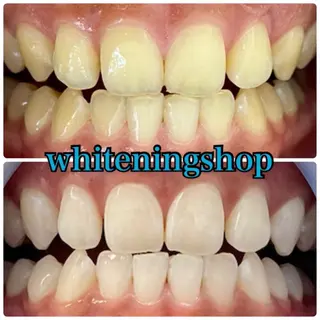 ホワイトニング ショップ吉祥寺店のエステ・リラクイメージ