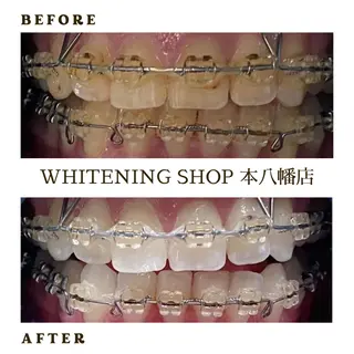 メンズ ホワイトニング ショップ本八幡店のエステ・リラクイメージ