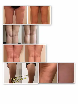 LOMILOMI Naoのエステ・リラクイメージ