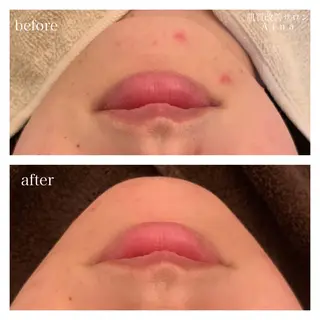 ロング カラー パーマ ヘアアレンジ メンズ キッズ ネイル マツエク・マツパ ニキビ跡専門サロン Ａｉｎａのエステ・リラクイメージ