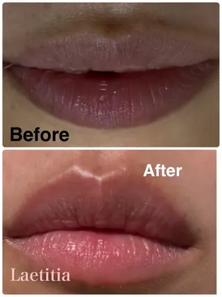 レティティア【Laetitia】所属・レティティア秋葉原店 Yoshizawaのエステ・リラクイメージ