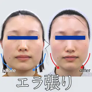 美.design 上野店のエステ・リラクイメージ