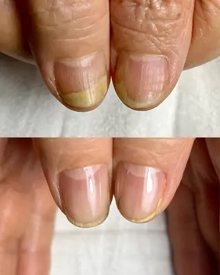 ネイル 佐藤 光のネイルデザイン