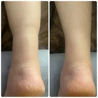 アロマ･美容鍼･カッ ピング「麗」鍼灸院のエステ・リラクイメージ