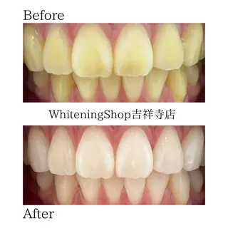 ホワイトニング ショップ吉祥寺店のエステ・リラクイメージ