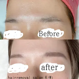 アイブロウ 脱毛サロン KiWiのエステ・リラクイメージ