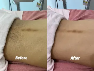 🫧美しい素肌へ🫧 今成柚乃のその他イメージ