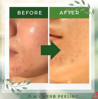 オーガニック エステ サロンフィオーレのエステ・リラクイメージ