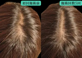 美容とカラダの鍼灸 サロン やなけんのエステ・リラクイメージ