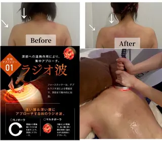 ブライダル痩身×脱毛 尼崎駅前サロンのエステ・リラクイメージ