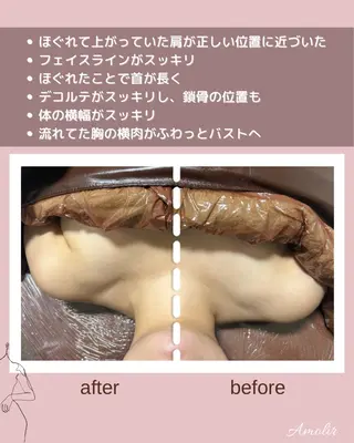 30代以降のボディ メイク Amolirのエステ・リラクイメージ