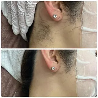 luana beauty所属・kana ハーブピーリング🌿のエステ・リラクイメージ