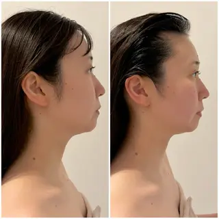 Lani Moon所属・⟡ 京都 小顔  ⊹ Lani Moonのエステ・リラクイメージ