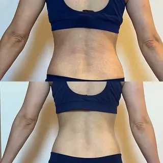 ダイエット専門店 SYELのエステ・リラクイメージ