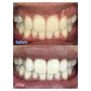 MBEAUTYSALON 千葉店・京成大久保所属・Melty 輝のその他イメージ