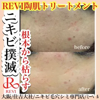 salon  mebell所属・肌管理専門店 mebell天王寺店のエステ・リラクイメージ