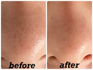 ÉMIA ✴︎のエステ・リラクイメージ