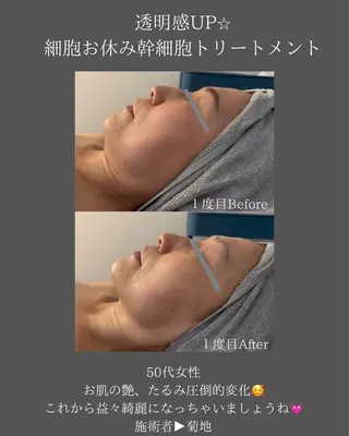 BLOSSOM 菊地のエステ・リラクイメージ