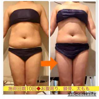 ショート カラー パーマ ヘアアレンジ メンズ キッズ ネイル マツエク・マツパ ‍痩身＆ボディ 結果出し🌟丹野のエステ・リラクイメージ