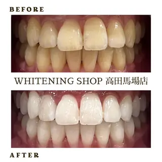 メンズ ホワイトニング ショップ高田馬場店のその他イメージ