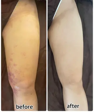 💎インディバ GEM💎indiba   healing room GEM所属・💎 GEM💎のエステ・リラクイメージ