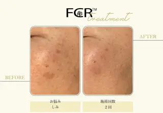 ララピール銀座 小顔フェイシャルのエステ・リラクイメージ