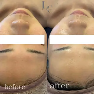 Le cherienのエステ・リラクイメージ