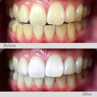 LBS吉祥寺 公式のエステ・リラクイメージ