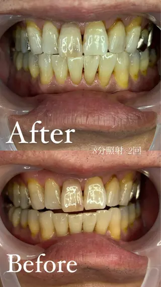 トータルビューティー サロン　Lisseの眉毛・アイブロウイメージ