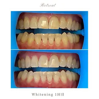 Retreatリトリート所属・歯科医院提携 Retreatのエステ・リラクイメージ