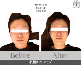 ヘッドスパ・小顔矯正　十色　横浜所属・ヘッドスパ・小顔矯正 十色　横浜のエステ・リラクイメージ