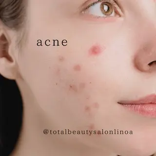 Salon💫 Lino'a柏店のエステ・リラクイメージ