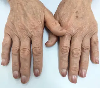 ネイル セプトネイル やすむらのネイルデザイン