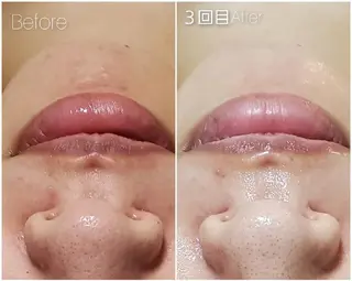 ALOHA RETREATのエステ・リラクイメージ