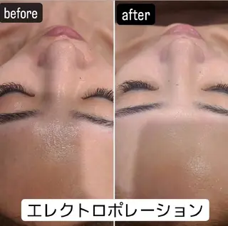 BEAUTYSARON　SiS.所属・高橋 沙奈江のエステ・リラクイメージ