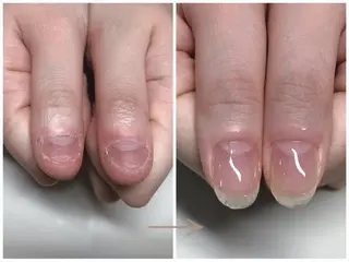 ネイル 深爪矯正・自爪育成 ヴェールリムのネイルデザイン