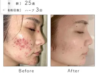 ハーブピーリング専門 BIOPLUS＋川崎のエステ・リラクイメージ