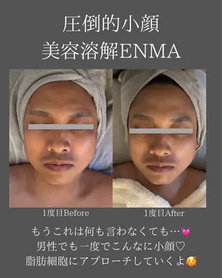 BLOSSOM 菊地のエステ・リラクイメージ