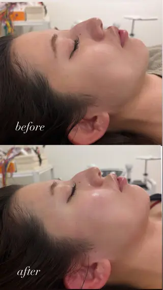 美容鍼灸サロン mahoroba院長のエステ・リラクイメージ