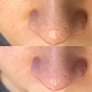 アイラッシュサロン CoCoのマツエク・マツパデザイン