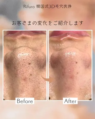 Rifuro 勝田台エステ所属・Rifuro勝田台 ララピール・毛穴洗浄のエステ・リラクイメージ