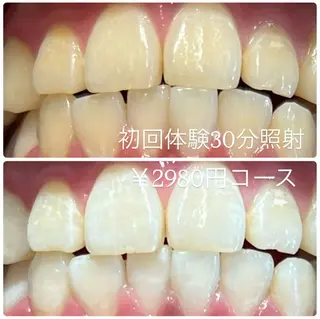 メンズ ホワイトニングルーム 川崎店所属・ホワイトニング ルーム 川崎店のその他イメージ