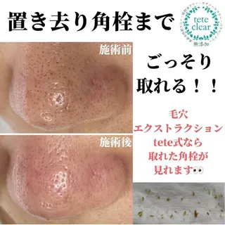 枝廣 貴子のエステ・リラクイメージ