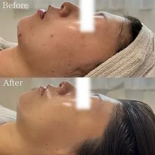 silo 結果重視の美肌サロンのエステ・リラクイメージ