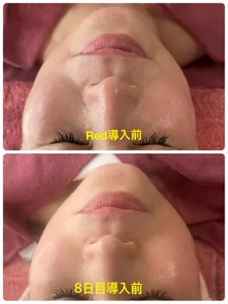 Lien オーナー 山口智嘉のエステ・リラクイメージ