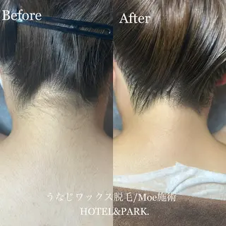 HOTEL&PARK .Moeワックス脱毛のエステ・リラクイメージ